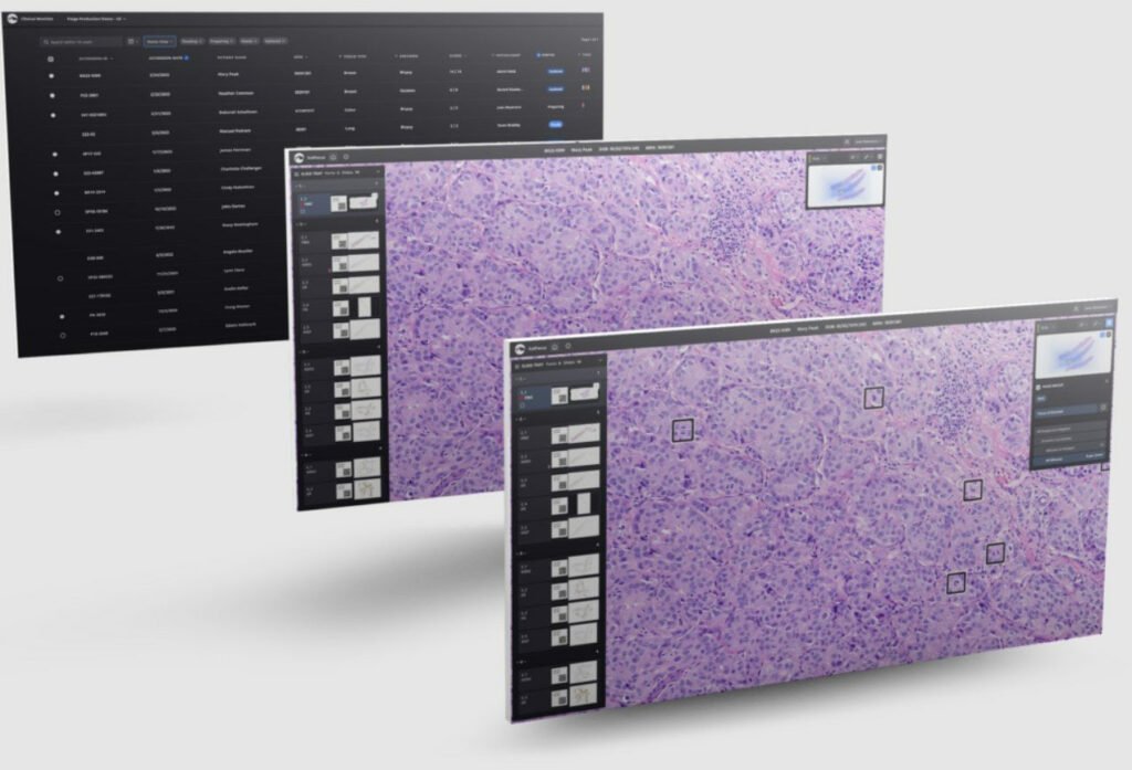 مایکروسافت بزرگ‌ترین مدل هوش مصنوعی تشخیص سرطان را می‌سازد