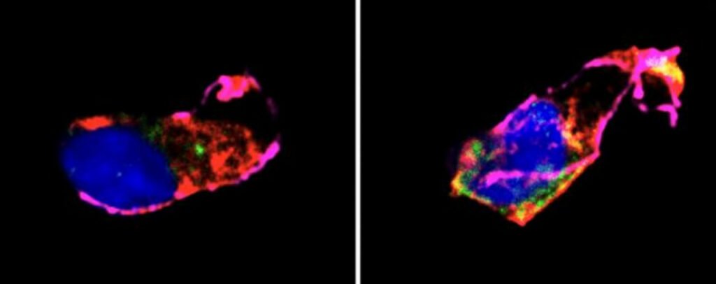 کمتر از ۷ ساعت خواب شبانه احتمال بیماری قلبی را افزایش می‌دهد