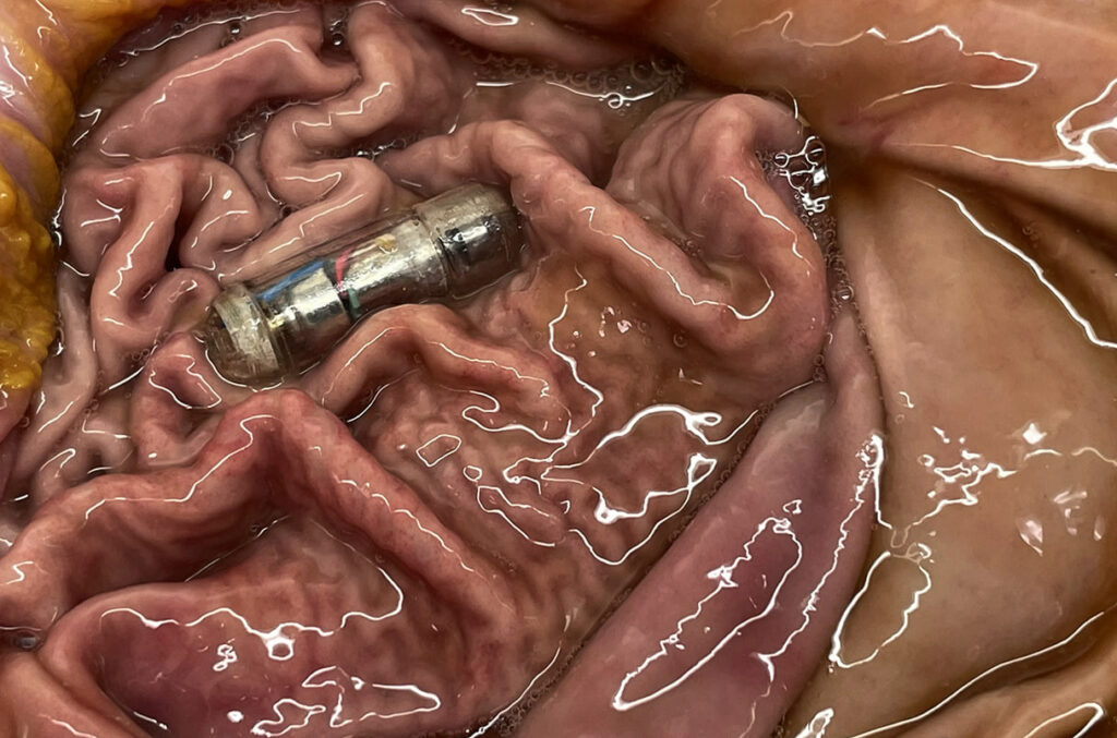 روشی تازه افت وزن؛ منفعت گیری از قرصی که با ارتعاش در معده، اشتها را کم میکند 4 1703408889 836 روشی تازه افت وزن؛ منفعت گیری از قرصی که با