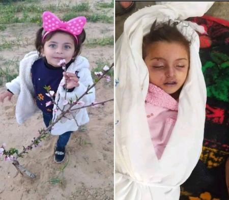 چشم‌هایی که دیگر نمی‌خندند+عکس | بهداشت نیوز_راسخ