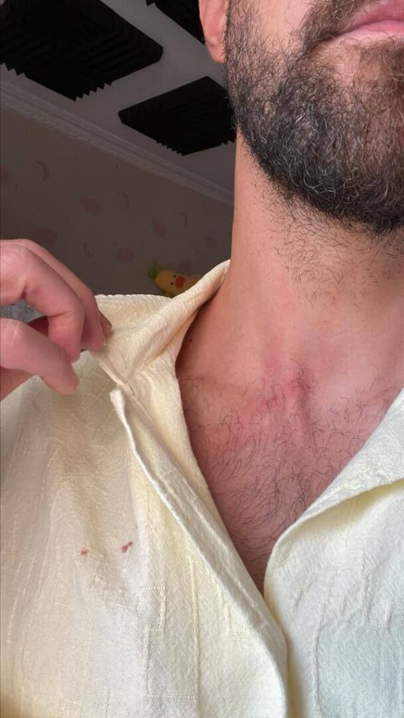 دعوا سارقان به مهاجم اسبق استقلال در اتوبان چمران تهران + عکس_راسخ