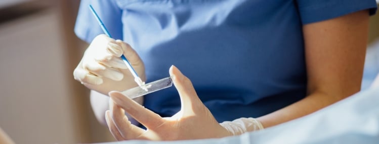 Can You Get a Pap Smear on Your Period?